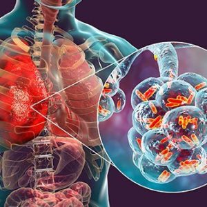 SAZIFLOX TZ IV Injection