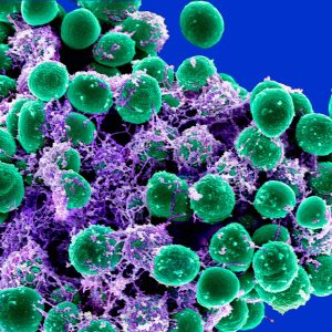 VERCOVOX-AZ LB Tablets