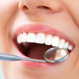 VM SORES Mouth Ulcer Gel