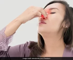 DARMIKOF Adult Nasal Spray